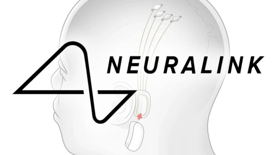 Elon Musk i Neuralink z powodzeniem wszczepili chip do ludzkiego mózgu